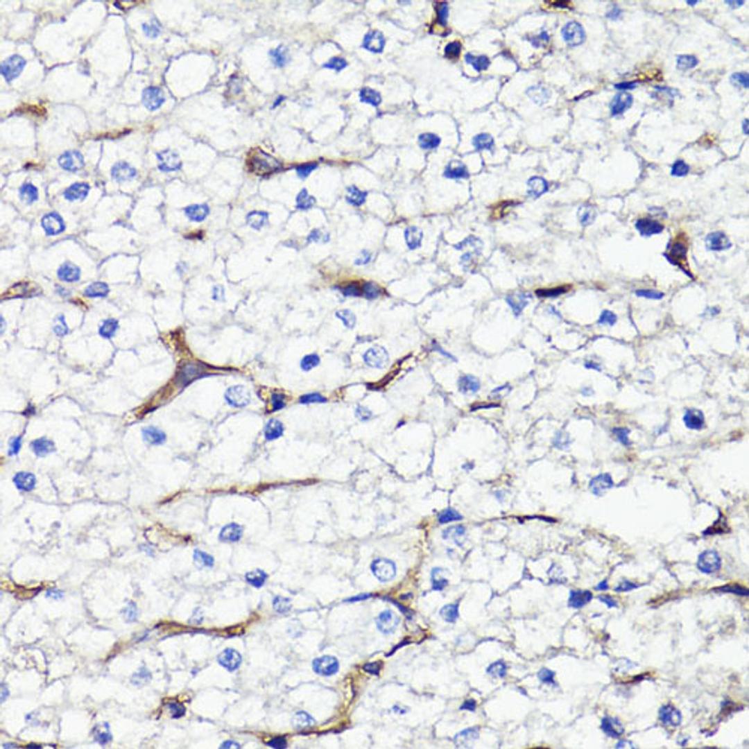 Immunohistochemistry  - CD44 antibody (A16807)