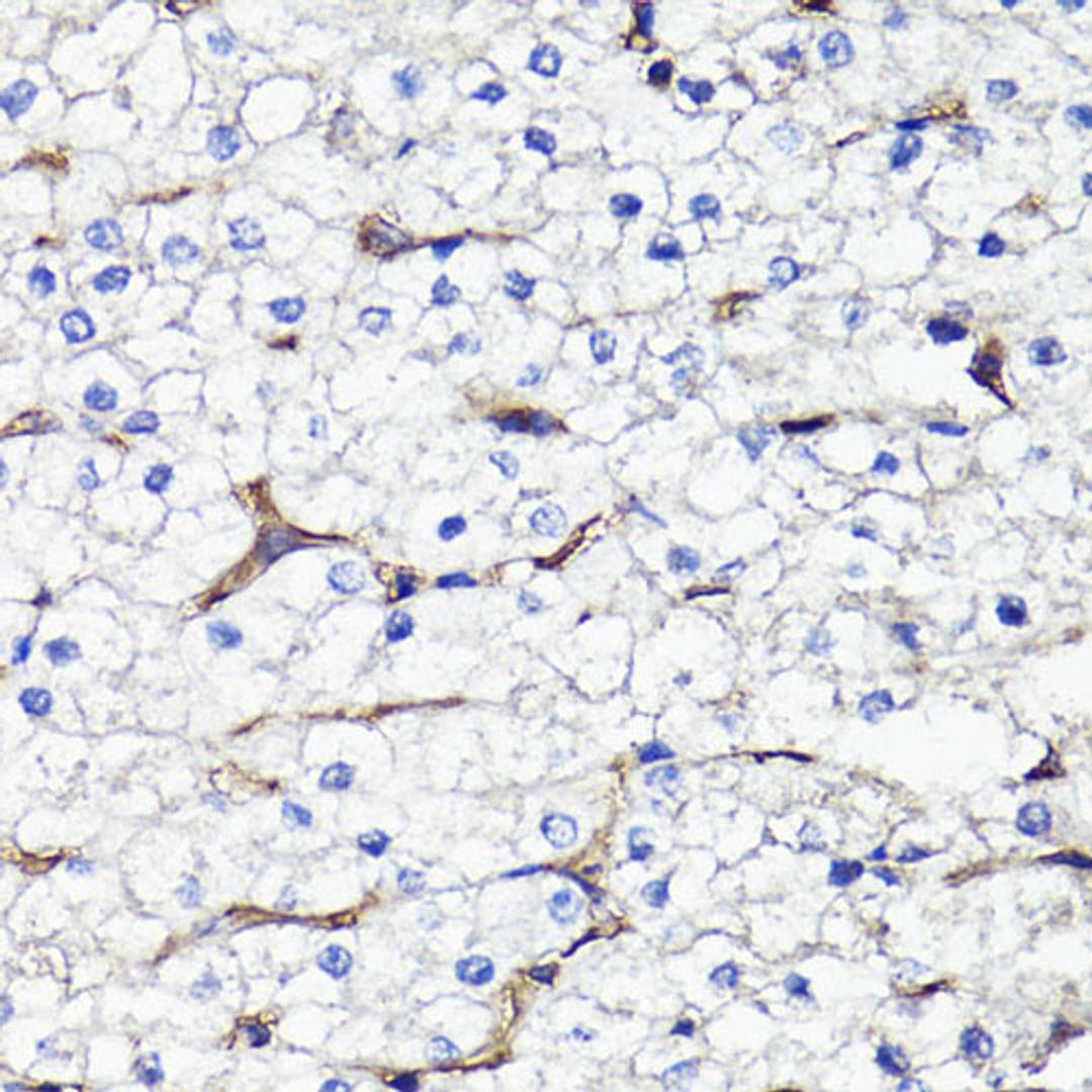 Immunohistochemistry - CD44 antibody (A16807)