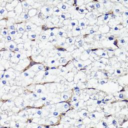 Immunohistochemistry - CD44 antibody (A16807)