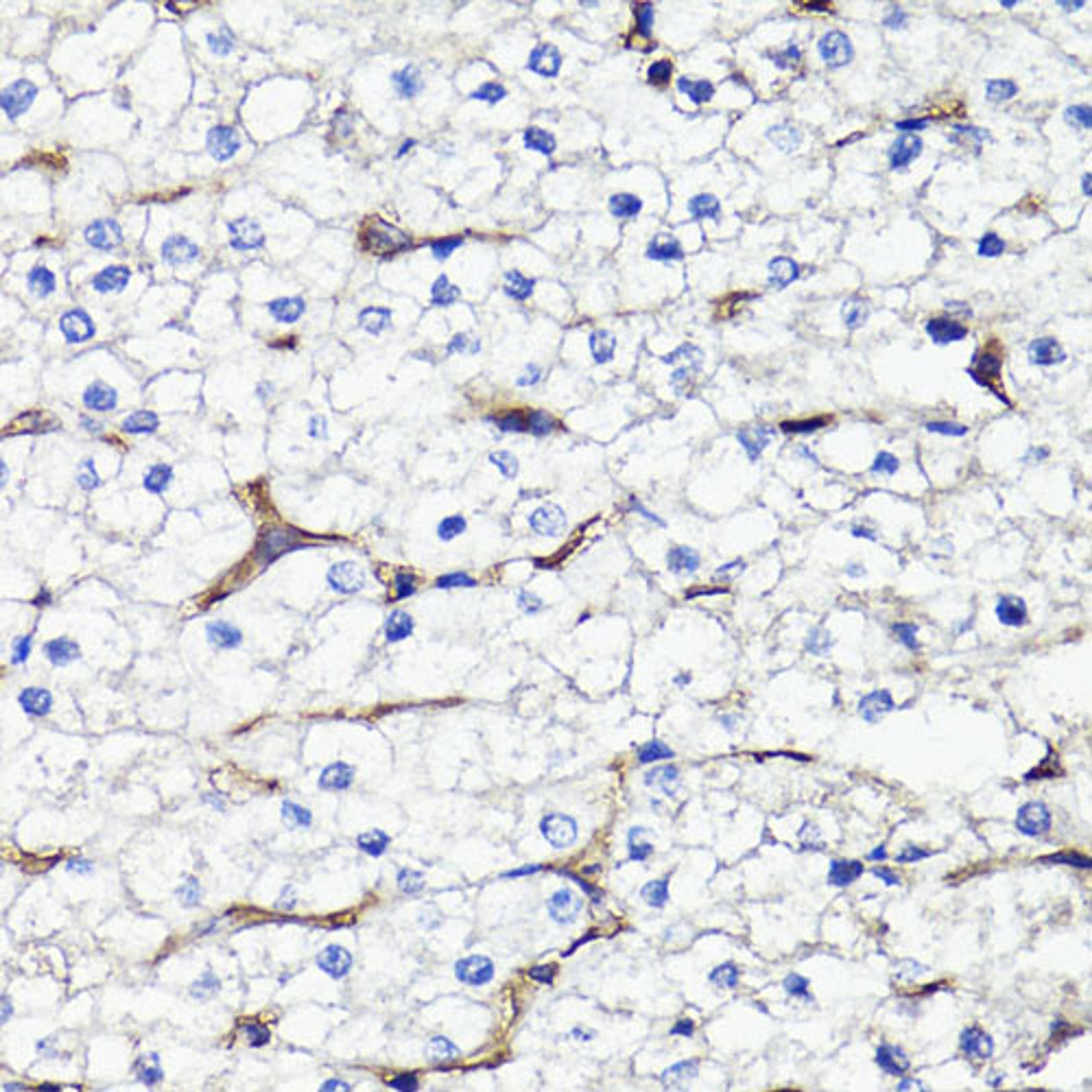 Immunohistochemistry - CD44 antibody (A16807)