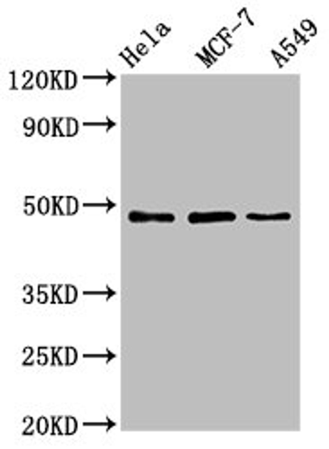 Western Blot. Positive WB detected in: Hela whole cell lysate, MCF-7 whole cell lysate, A549 whole cell lysate. All lanes: LCOR antibody at 4.6ug/ml. Secondary. Goat polyclonal to rabbit IgG at 1/50000 dilution. Predicted band size: 48, 45, 107 kDa. Observed band size: 48 kDa.