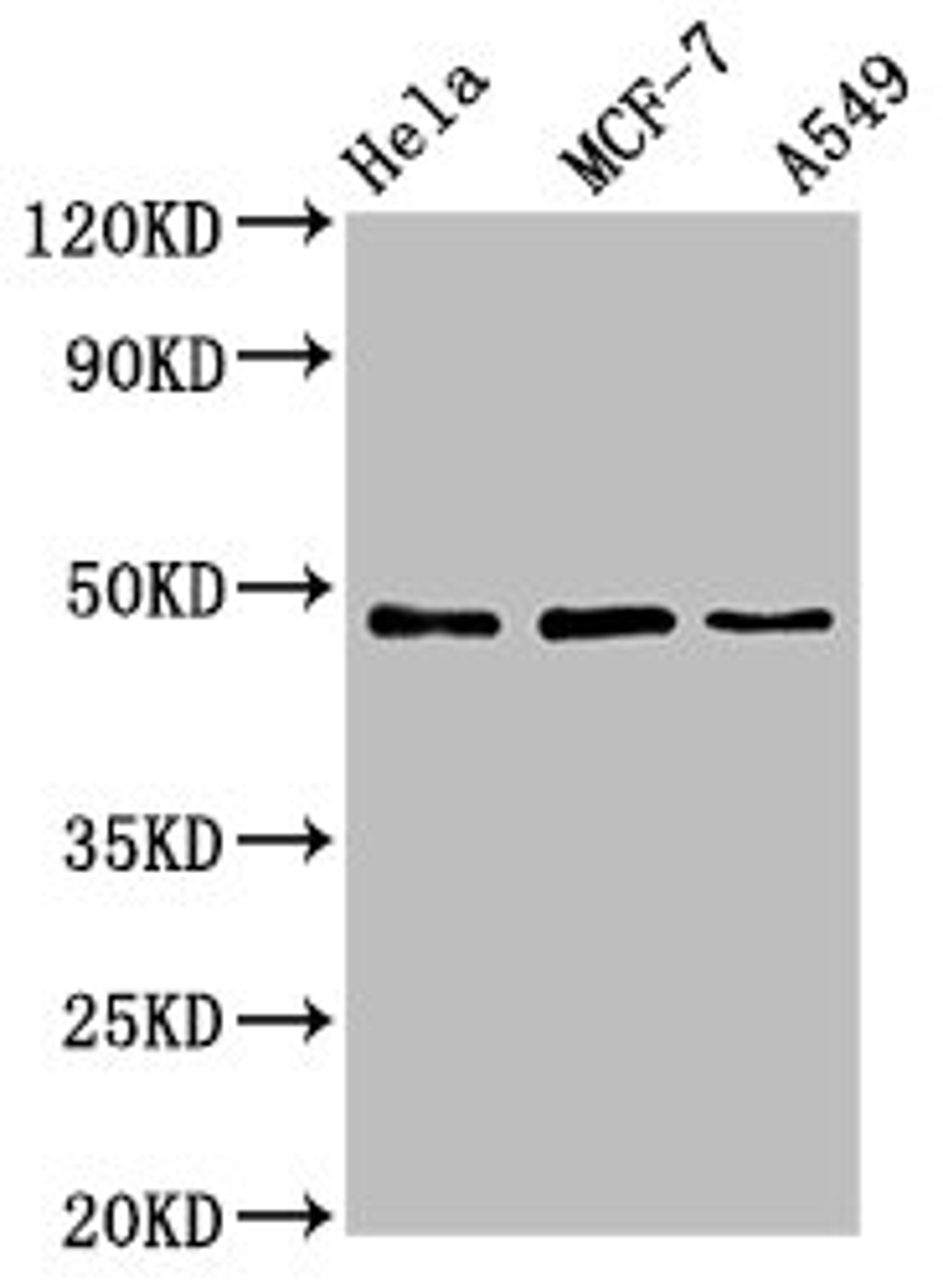Western Blot. Positive WB detected in: Hela whole cell lysate, MCF-7 whole cell lysate, A549 whole cell lysate. All lanes: LCOR antibody at 4.6ug/ml. Secondary. Goat polyclonal to rabbit IgG at 1/50000 dilution. Predicted band size: 48, 45, 107 kDa. Observed band size: 48 kDa.
