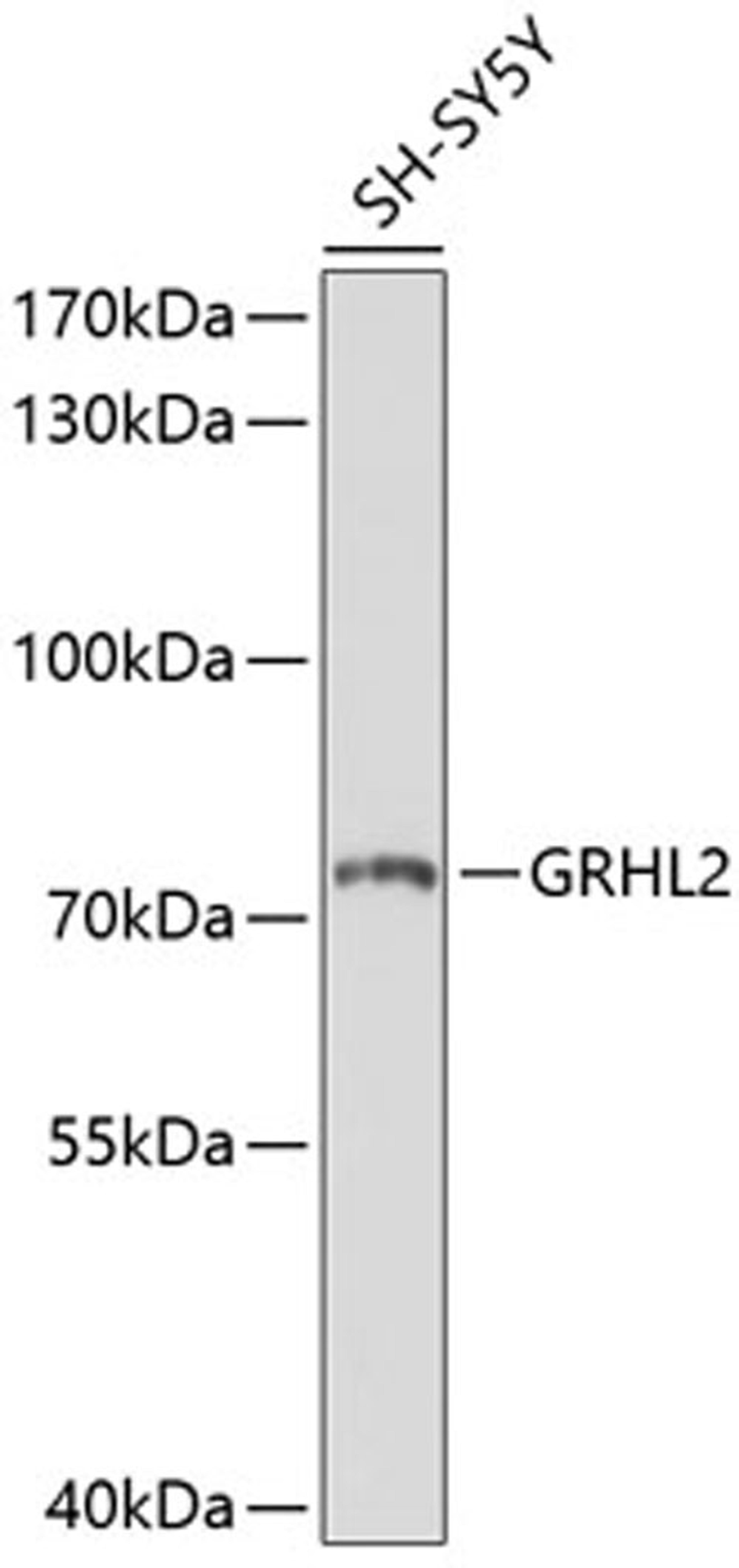 Western blot - GRHL2 antibody (A10153)