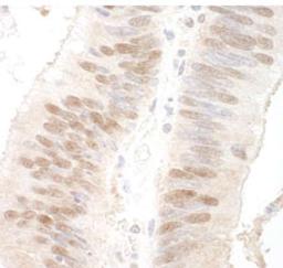 Detection of human MBD3 by immunohistochemistry.