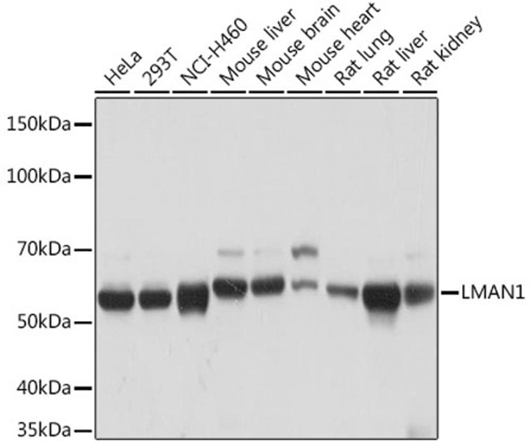 Western blot - LMAN1 Rabbit mAb (A4941)