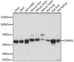 Western blot - LMAN1 Rabbit mAb (A4941)