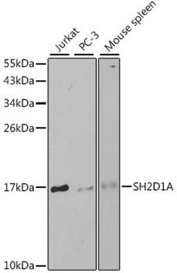 Western blot - SH2D1A antibody (A1143)