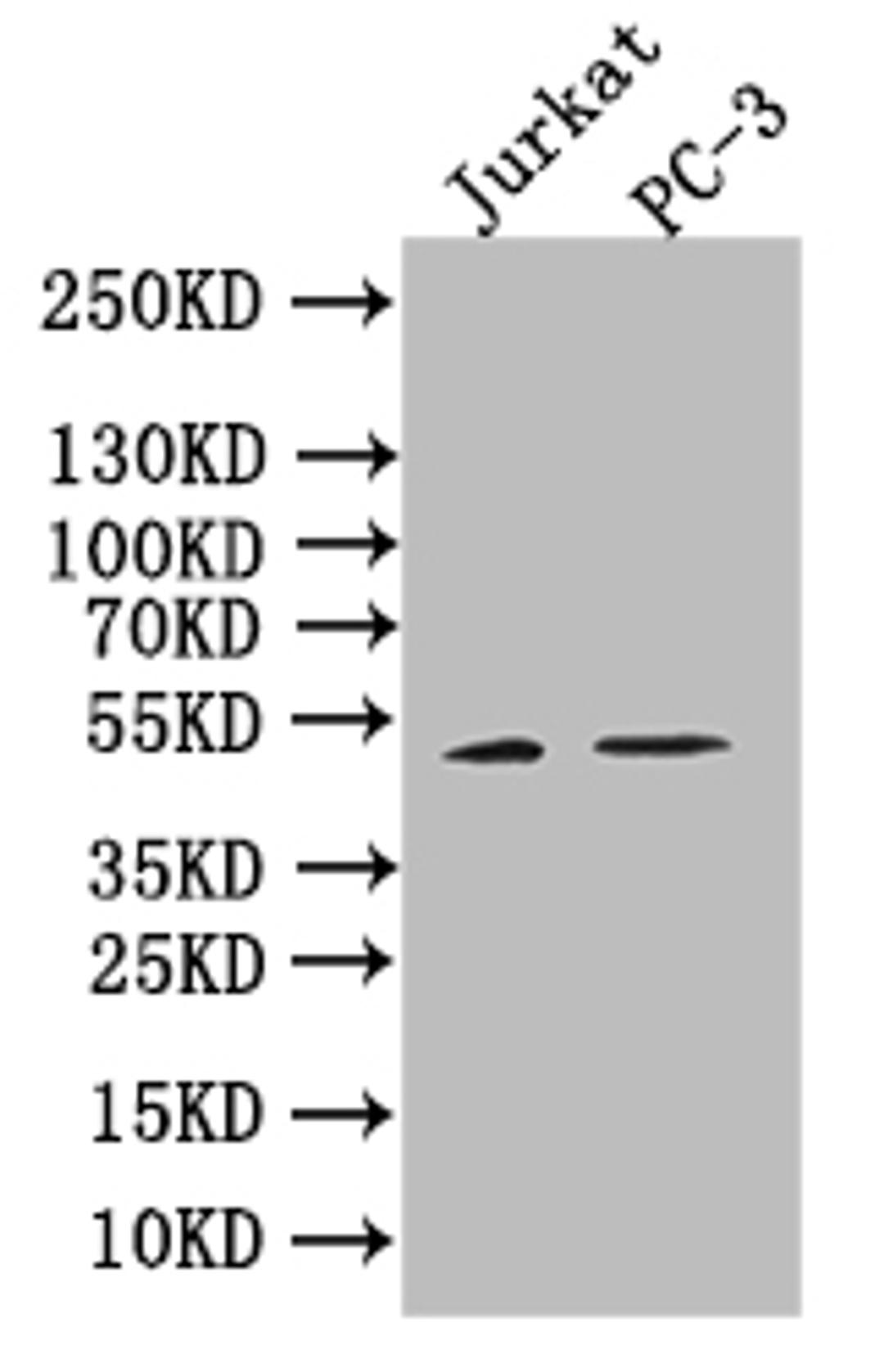 Western blot. All lanes: B7H6 antibody at 2 ug/ml. Lane 1: Mouse heart tissue. Lane 2: Mouse liver tissue. Lane 3: Mouse brain tissue. Lane 4: Hela whole cell lysate. Secondary. Goat polyclonal to rabbit IgG at 1/10000 dilution. Predicted band size: 51 kDa. Observed band size: 51, 38, 32 kDa. 