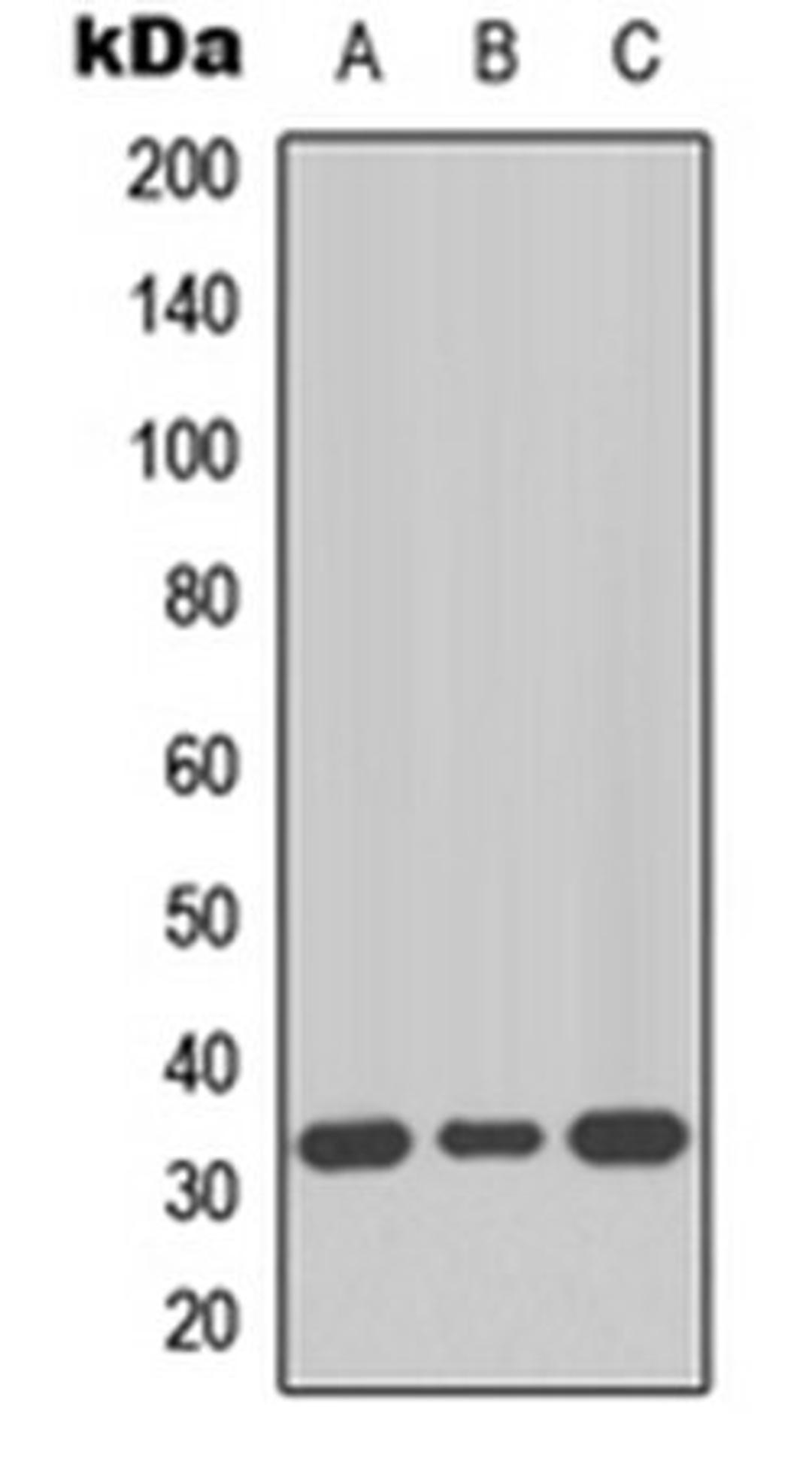 Western blot analysis of HeLa (Lane 1), SW480 (Lane 2), HepG2 (Lane 3) whole cell lysates using MKI67IP antibody