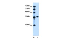 Antibody used in WB on Human Jurkat 0.2-1 ug/ml.