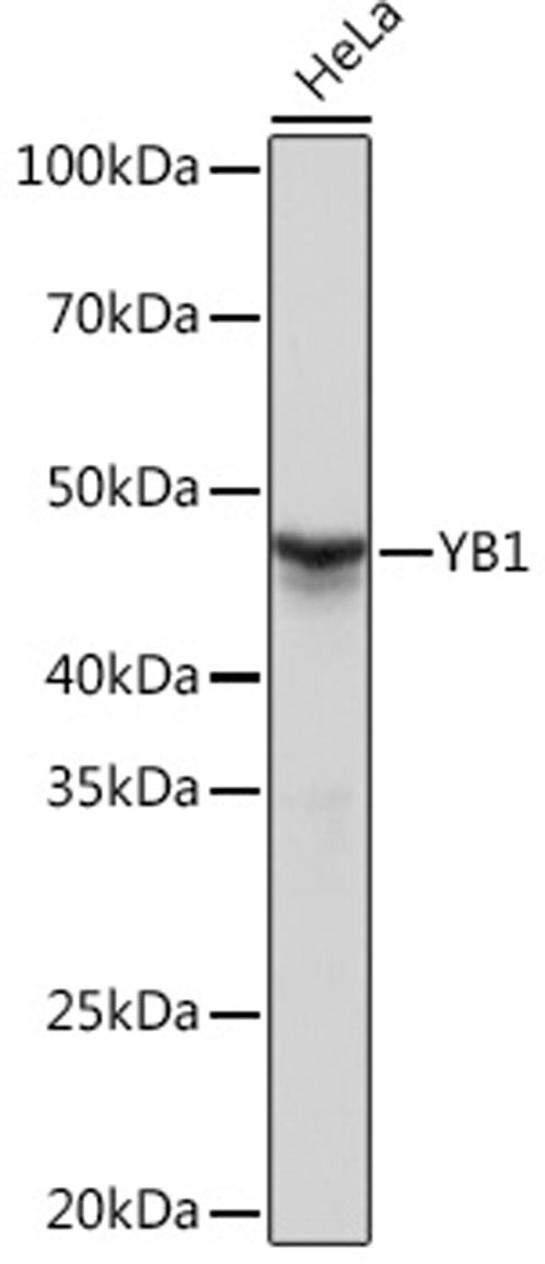 Western blot - YB1 Rabbit mAb (A3534)