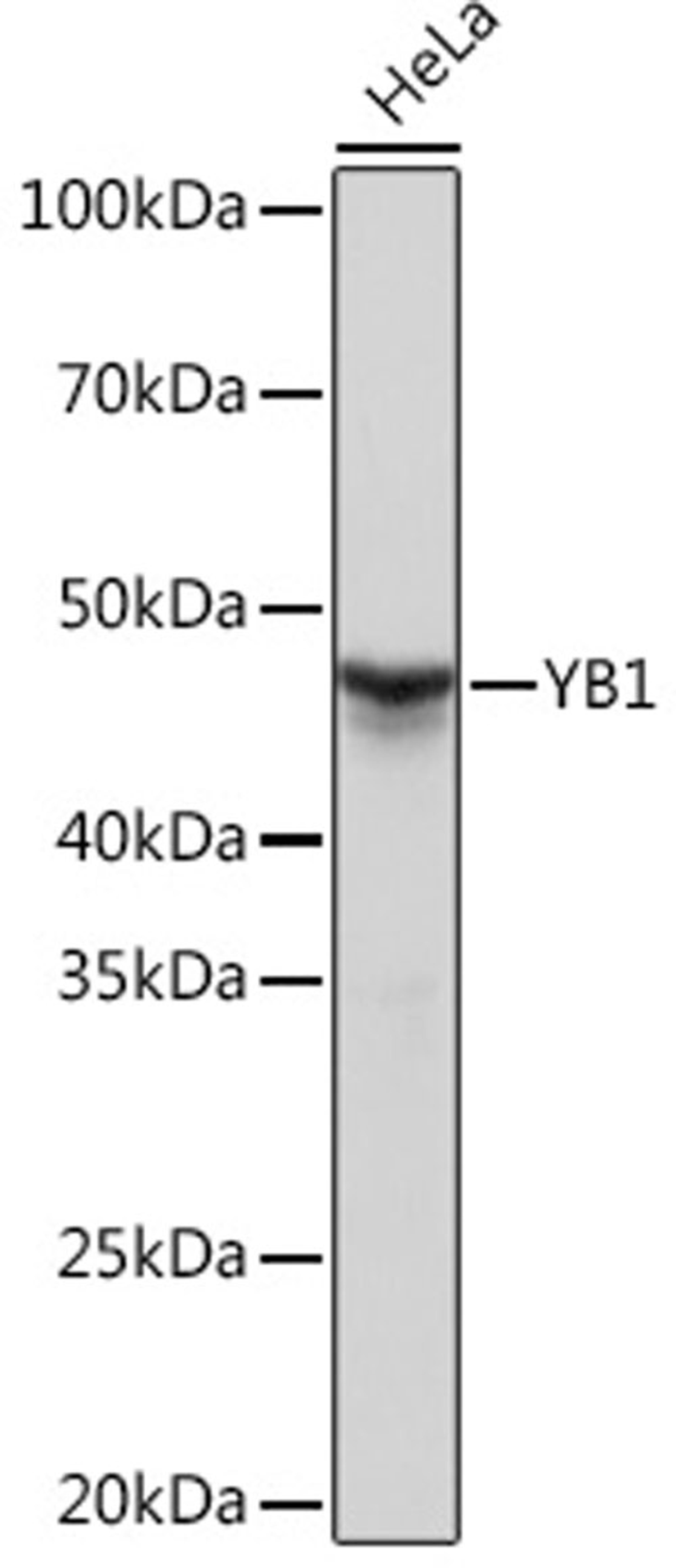 Western blot - YB1 Rabbit mAb (A3534)