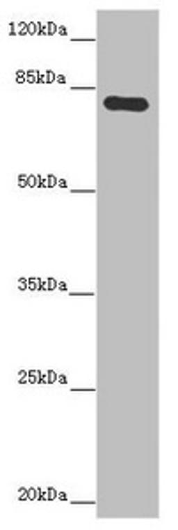 Western blot. All lanes: MOCS1 antibody at 5.09 ug/ml.  + Mouse heart tissue. Secondary. Goat polyclonal to rabbit IgG at 1/10000 dilution. Predicted band size: 71, 44, 41, 32, 69, 59 kDa. Observed band size: 71 kDa. 