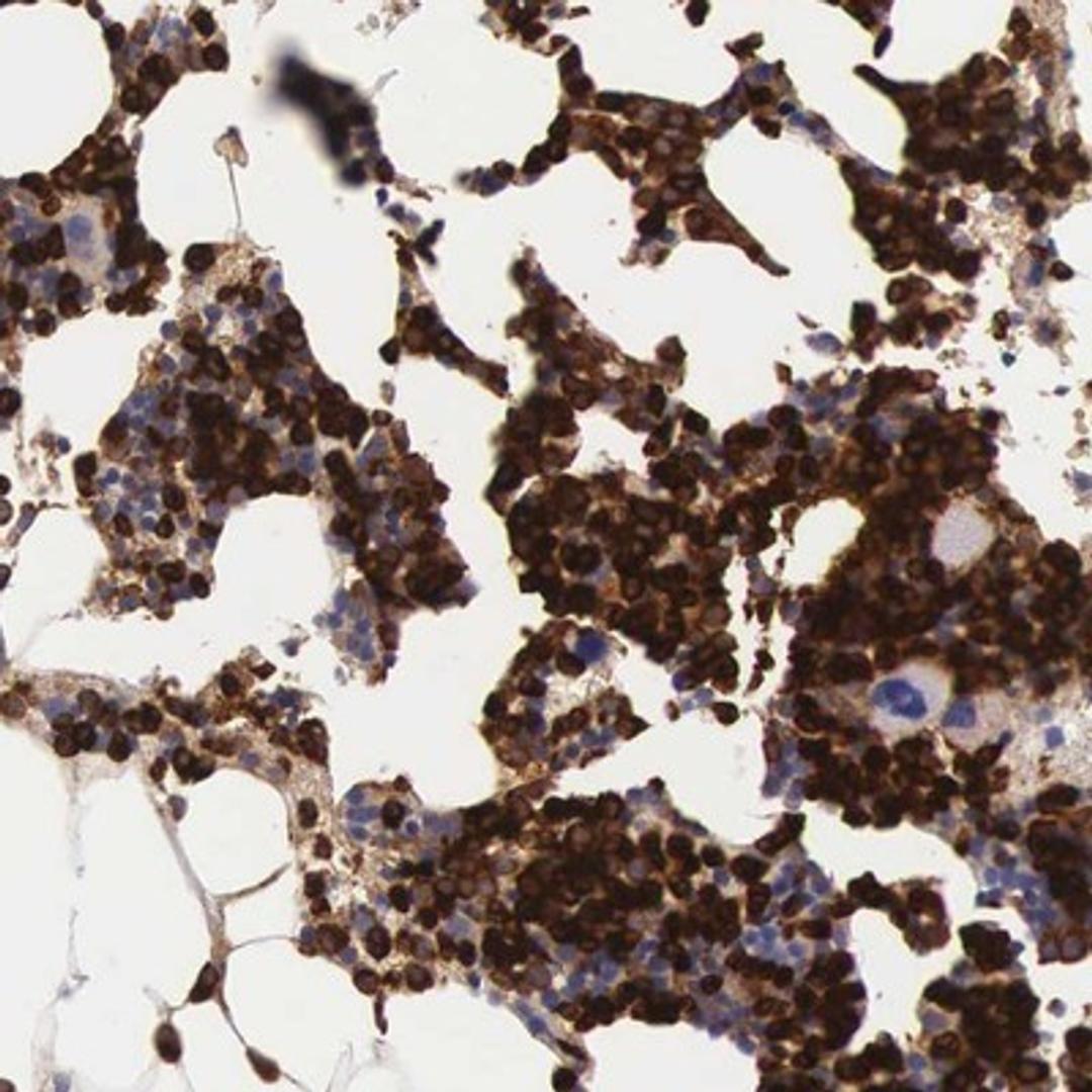 Immunohistochemistry-Paraffin: FCN1 Antibody [NBP1-84706] - Staining of human bone marrow shows strong cytoplasmic positivity in bone marrow poietic cells.