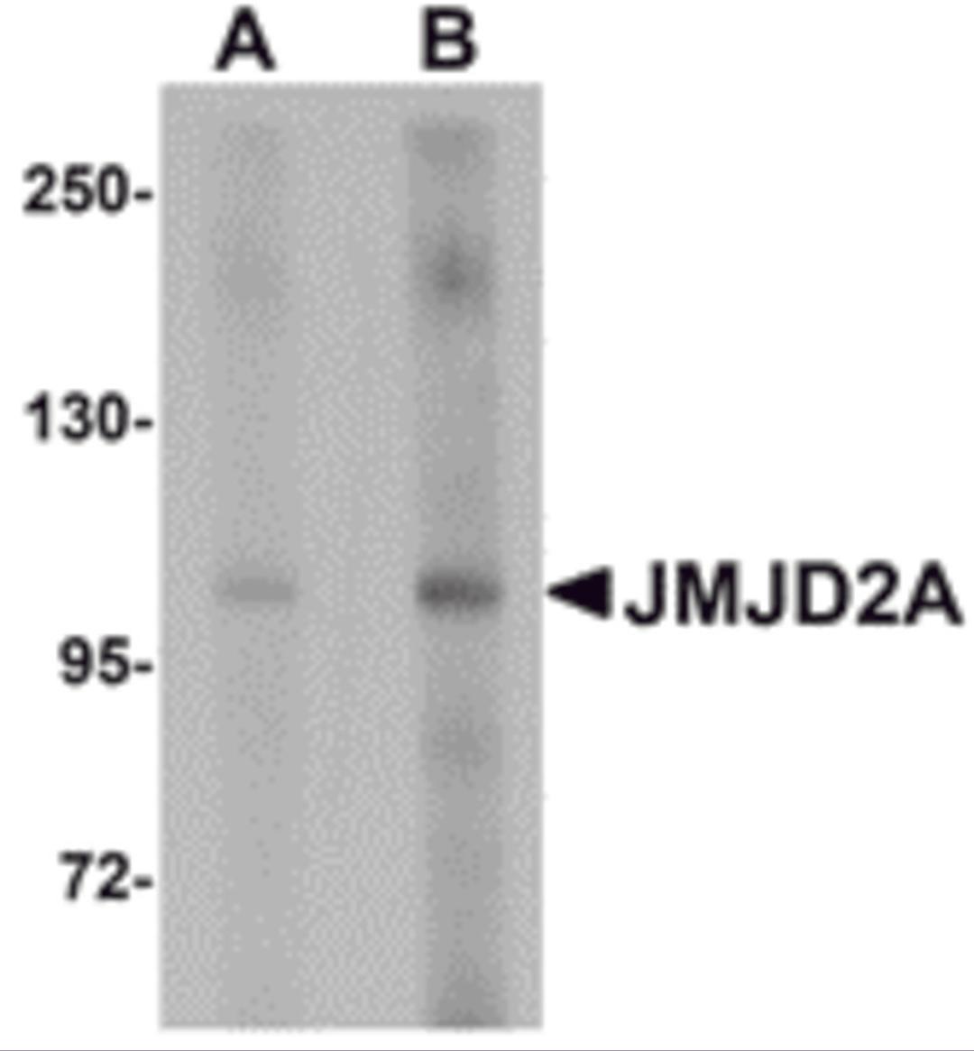 Western blot analysis of JMJD2A in rat liver tissue lysate with JMJD2A antibody at (A) 1 and (B) 2 &#956;g/mL.