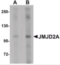 Western blot analysis of JMJD2A in rat liver tissue lysate with JMJD2A antibody at (A) 1 and (B) 2 &#956;g/mL.