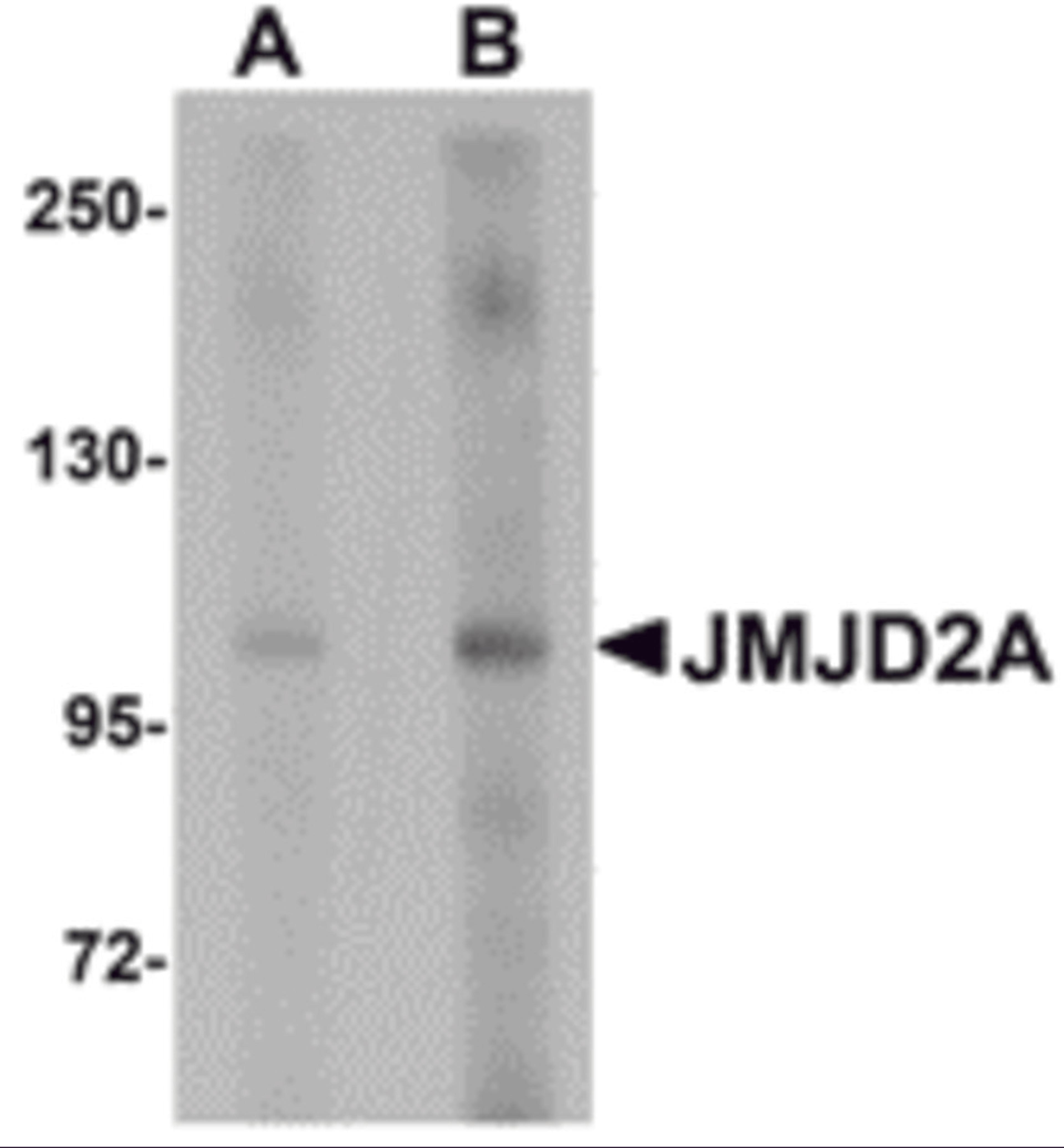 Western blot analysis of JMJD2A in rat liver tissue lysate with JMJD2A antibody at (A) 1 and (B) 2 &#956;g/mL.