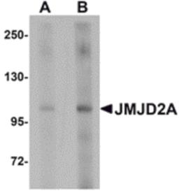 Western blot analysis of JMJD2A in rat liver tissue lysate with JMJD2A antibody at (A) 1 and (B) 2 μg/mL.