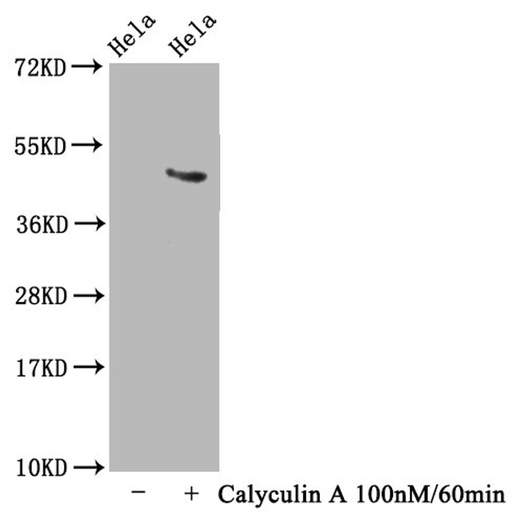 Western Blot. Positive WB detected in Hela whole cell lysate(treated with Calyculin A or not). All lanes Phospho-MAPT antibody at 1.63μg/ml. Secondary. Goat polyclonal to rabbit IgG at 1/50000 dilution. Predicted band size: 46 KDa. Observed band size: 46 KDa.