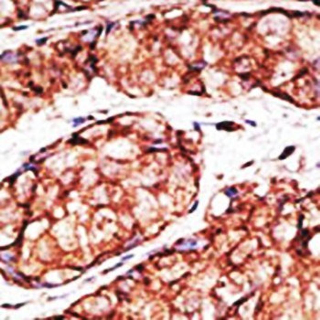 Immunohistochemical analysis of formalin-fixed paraffin embedded human cancer tissue using Mouse TLR5 antibody