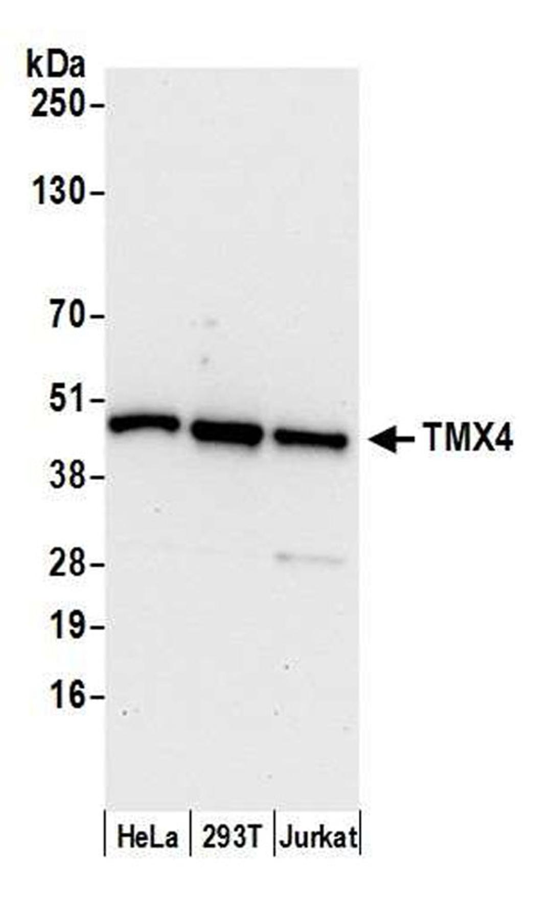 Detection of human TMX4 by WB.