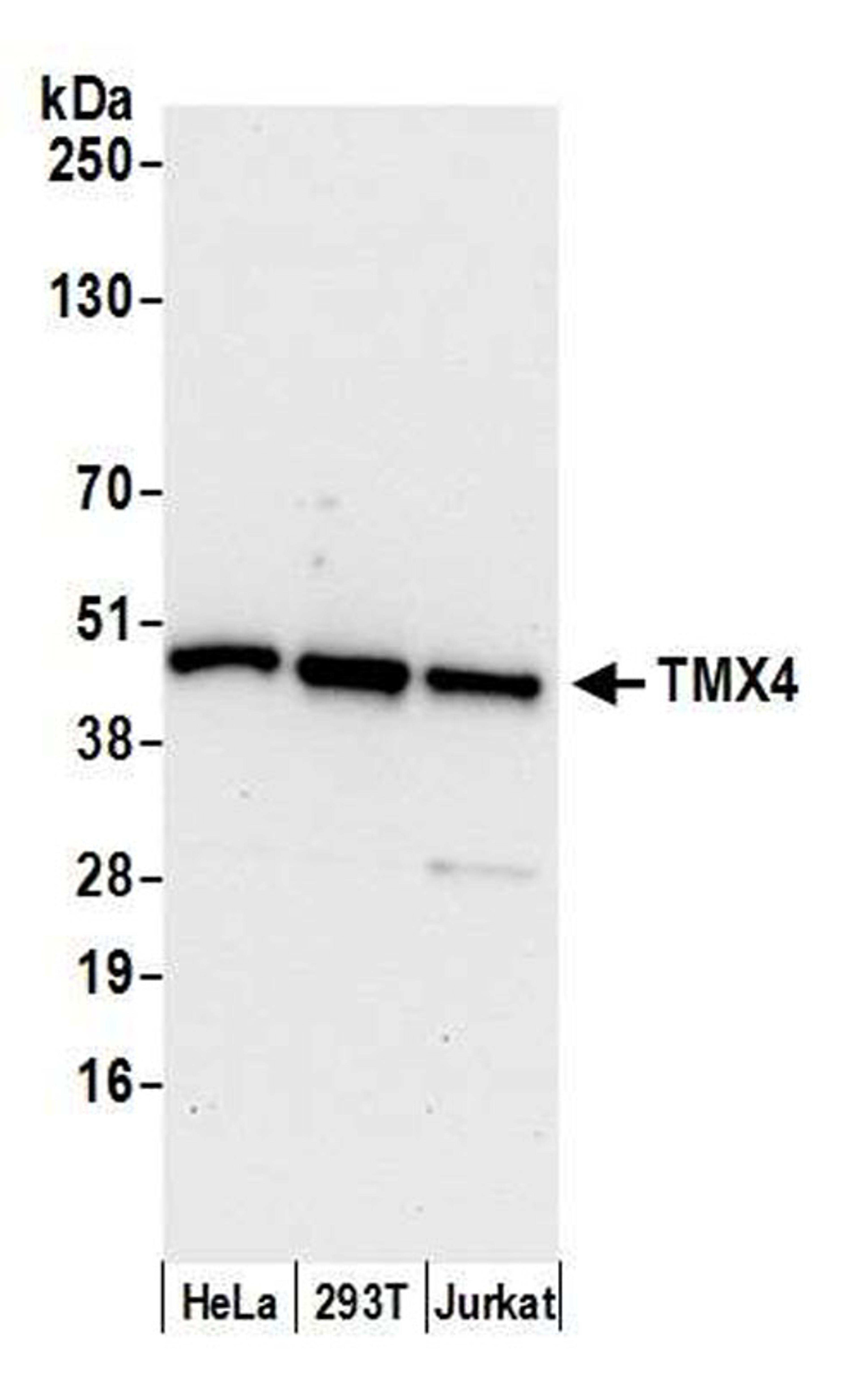 Detection of human TMX4 by WB.