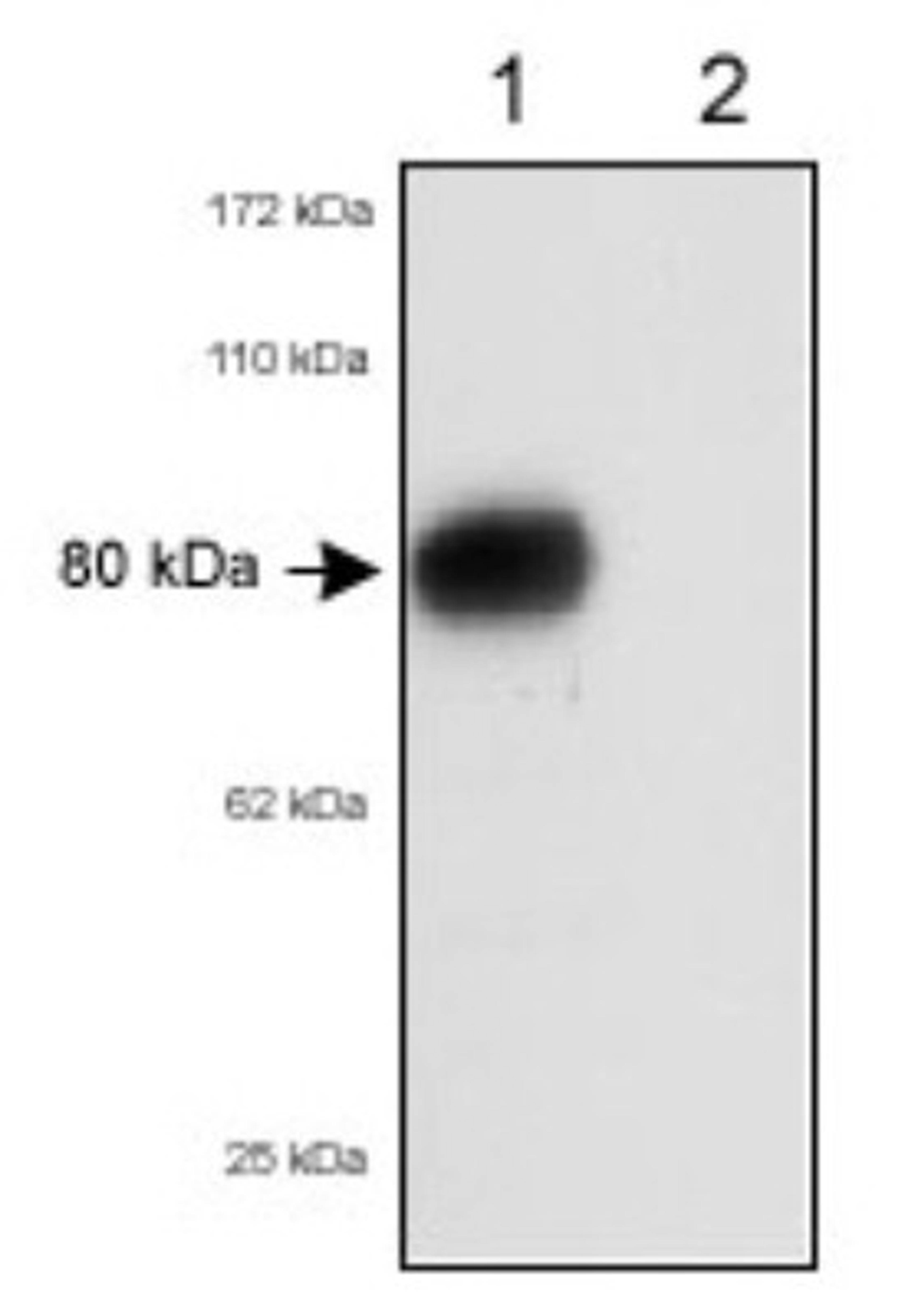 Western Blot: SR-BI/SR-BII Antibody [NB400-134] - Detection of RED-1 in 80 ug of total mouse liver lysates. Lane 1: wild-type mice, Lane 2: SR-BI deficient mice.