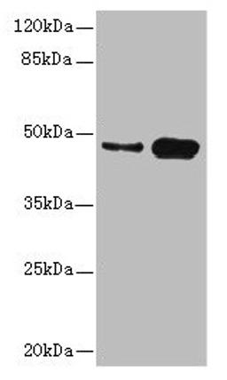 Western blot. All lanes: CSNK1G2 antibody at 4.21ug/ml. Lane 1: Mouse gonadal tissue. Lane 2: Hela whole cell lysate. Secondary. Goat polyclonal to rabbit IgG at 1/10000 dilution. Predicted band size: 47 kDa. Observed band size: 47 kDa. 