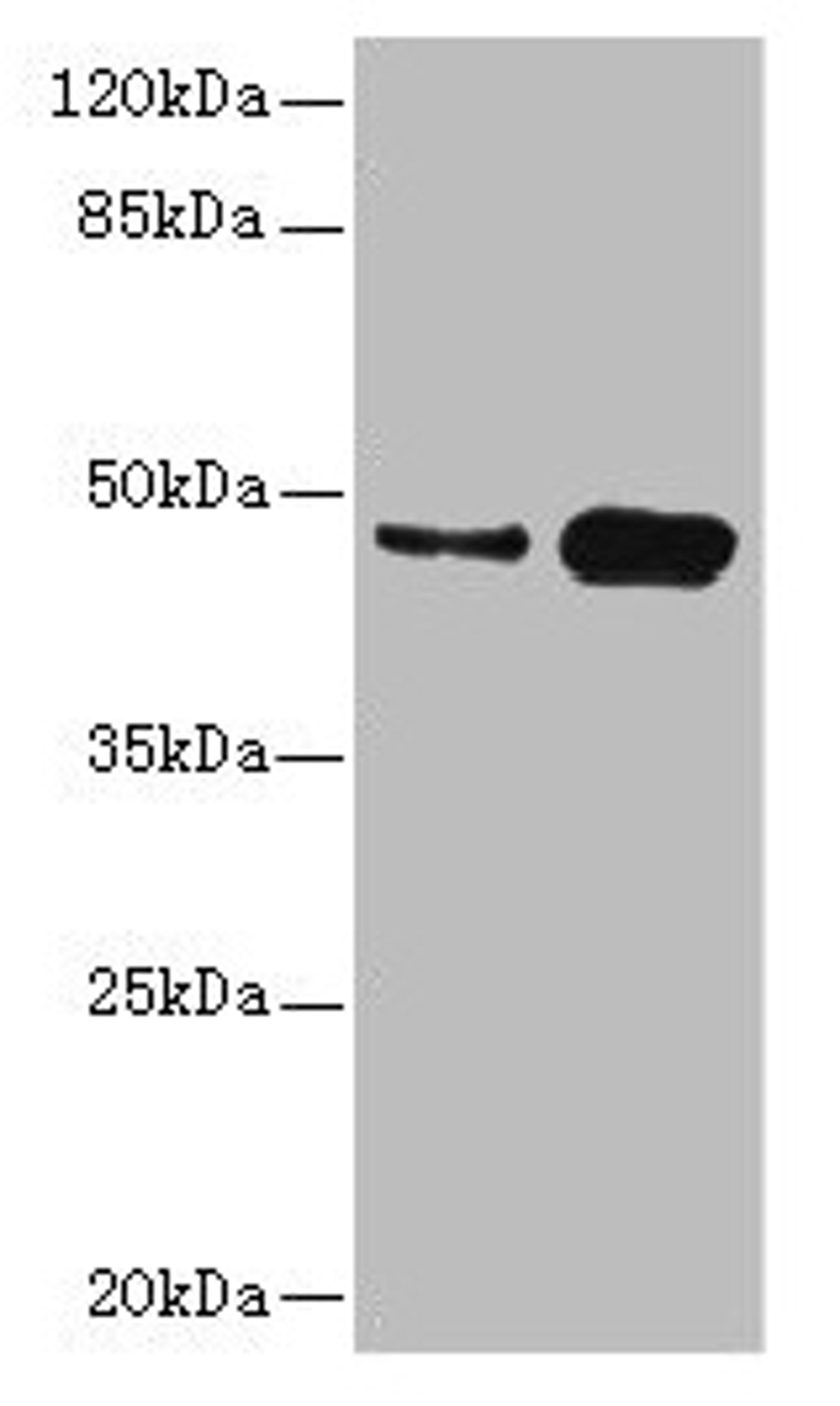 Western blot. All lanes: CSNK1G2 antibody at 4.21ug/ml. Lane 1: Mouse gonadal tissue. Lane 2: Hela whole cell lysate. Secondary. Goat polyclonal to rabbit IgG at 1/10000 dilution. Predicted band size: 47 kDa. Observed band size: 47 kDa. 