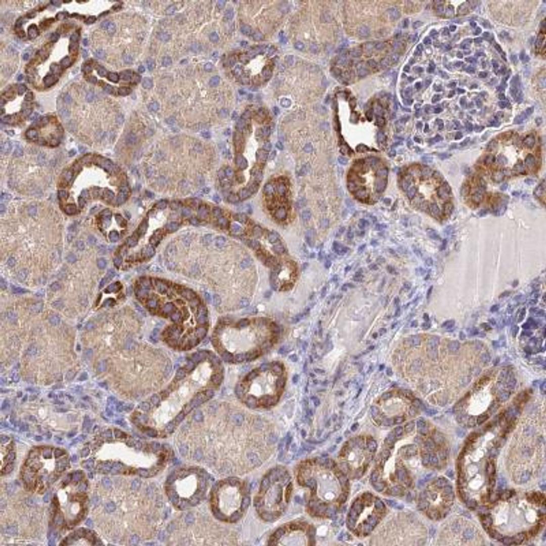 Immunohistochemistry: NIPSNAP3A Antibody [NBP2-46674] - Analysis  of human kidney shows strong cytoplasmic positivity in cells in tubules.