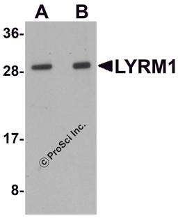 Western blot analysis of LYRM1 in human liver tissue lysate with LYRM1 antibody at (A) 1 and (B) 2 μg/mL.