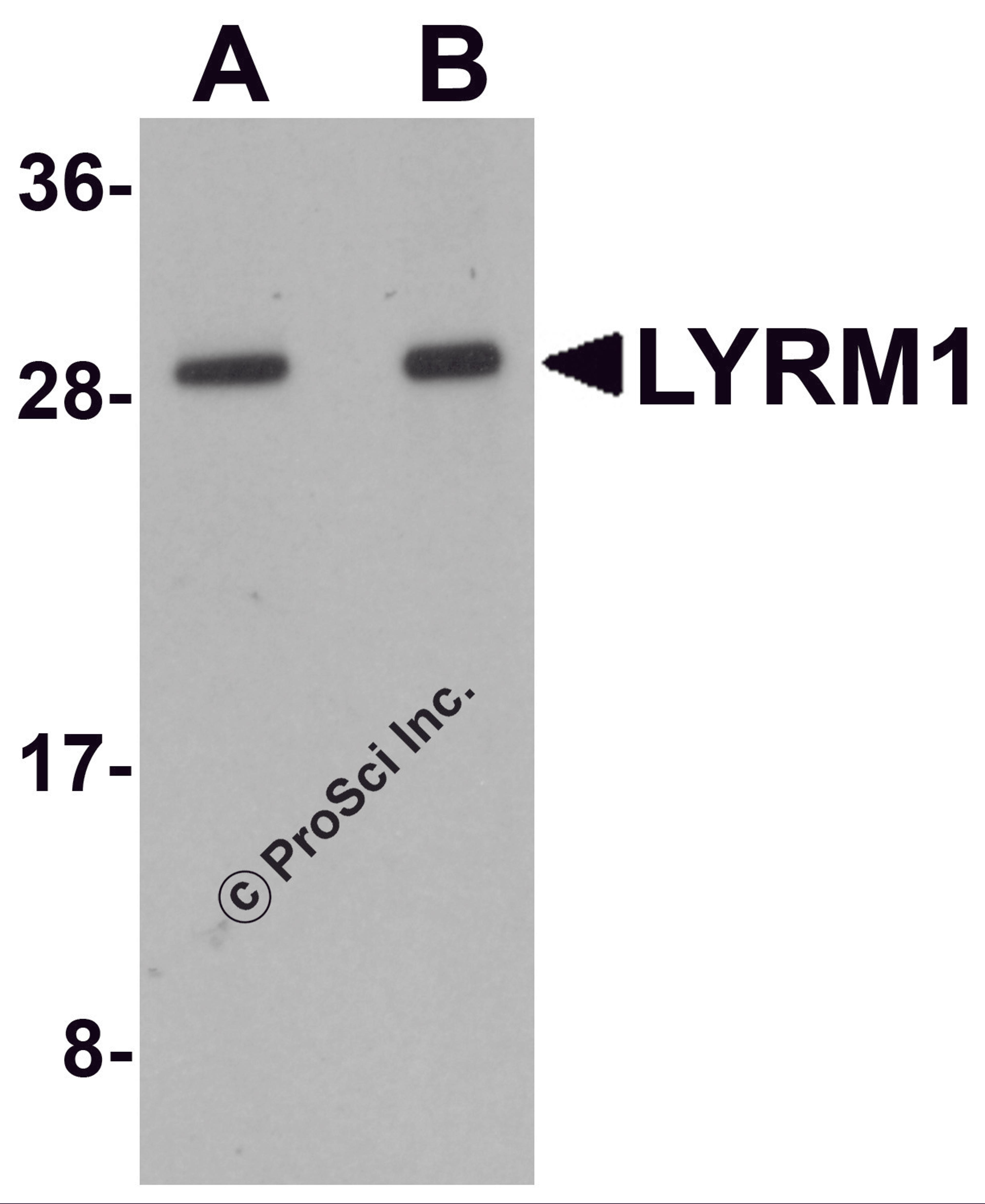 Western blot analysis of LYRM1 in human liver tissue lysate with LYRM1 antibody at (A) 1 and (B) 2 μg/mL.