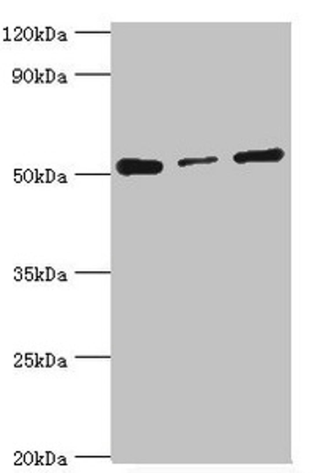 Western blot. All lanes: Programmed cell death protein 4 antibody at 4ug/ml. Lane 1: Hela whole cell lysate. Lane 2: MCF-7 whole cell lysate. Lane 3: Jurkat whole cell lysate. Secondary. Goat polyclonal to rabbit IgG at 1/10000 dilution. Predicted band size: 52, 51 kDa. Observed band size: 52 kDa.
