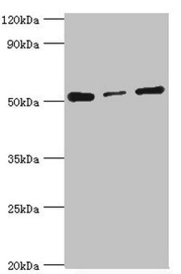 Western blot. All lanes: Programmed cell death protein 4 antibody at 4ug/ml. Lane 1: Hela whole cell lysate. Lane 2: MCF-7 whole cell lysate. Lane 3: Jurkat whole cell lysate. Secondary. Goat polyclonal to rabbit IgG at 1/10000 dilution. Predicted band size: 52, 51 kDa. Observed band size: 52 kDa.