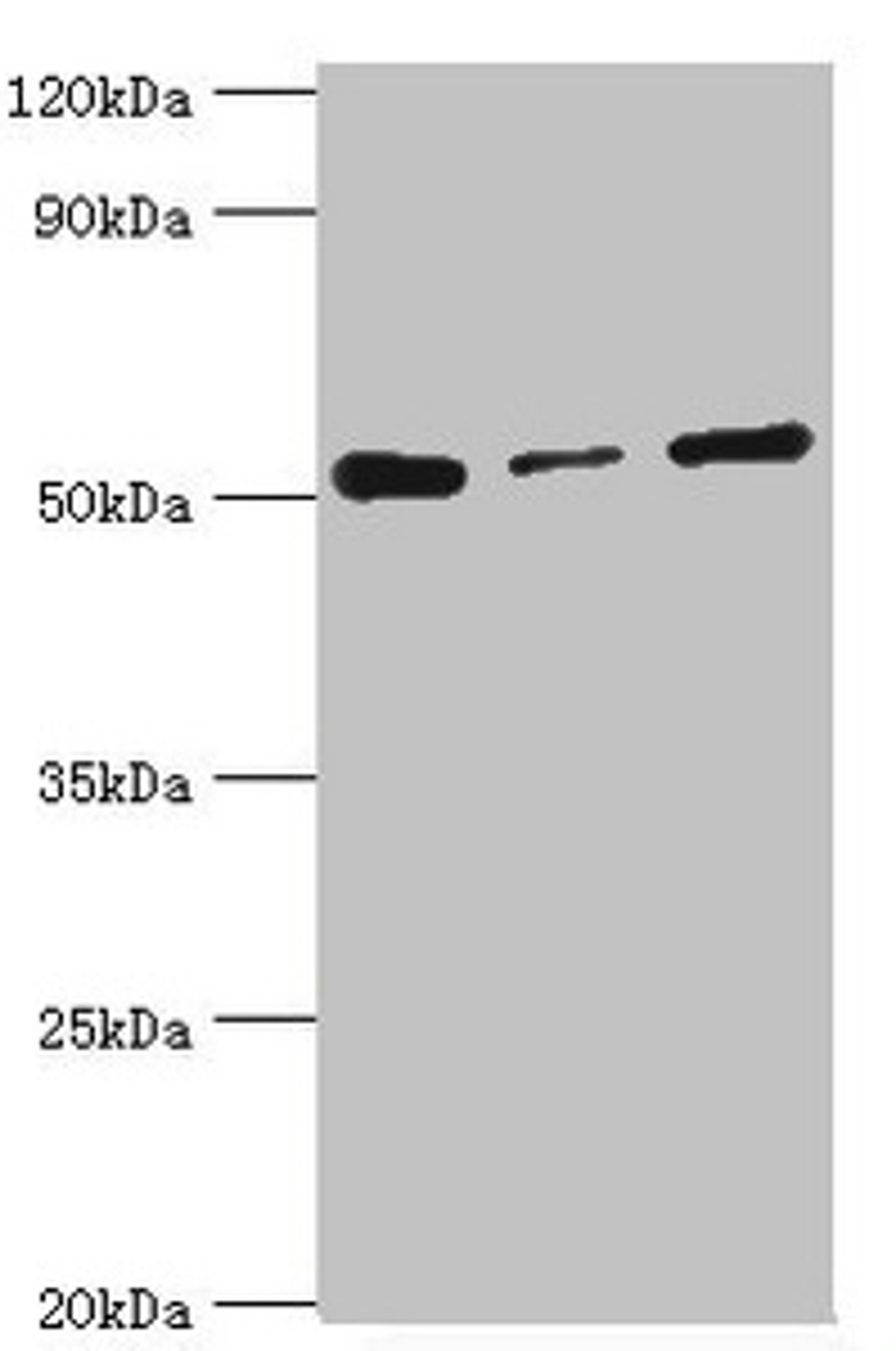 Western blot. All lanes: Programmed cell death protein 4 antibody at 4ug/ml. Lane 1: Hela whole cell lysate. Lane 2: MCF-7 whole cell lysate. Lane 3: Jurkat whole cell lysate. Secondary. Goat polyclonal to rabbit IgG at 1/10000 dilution. Predicted band size: 52, 51 kDa. Observed band size: 52 kDa.