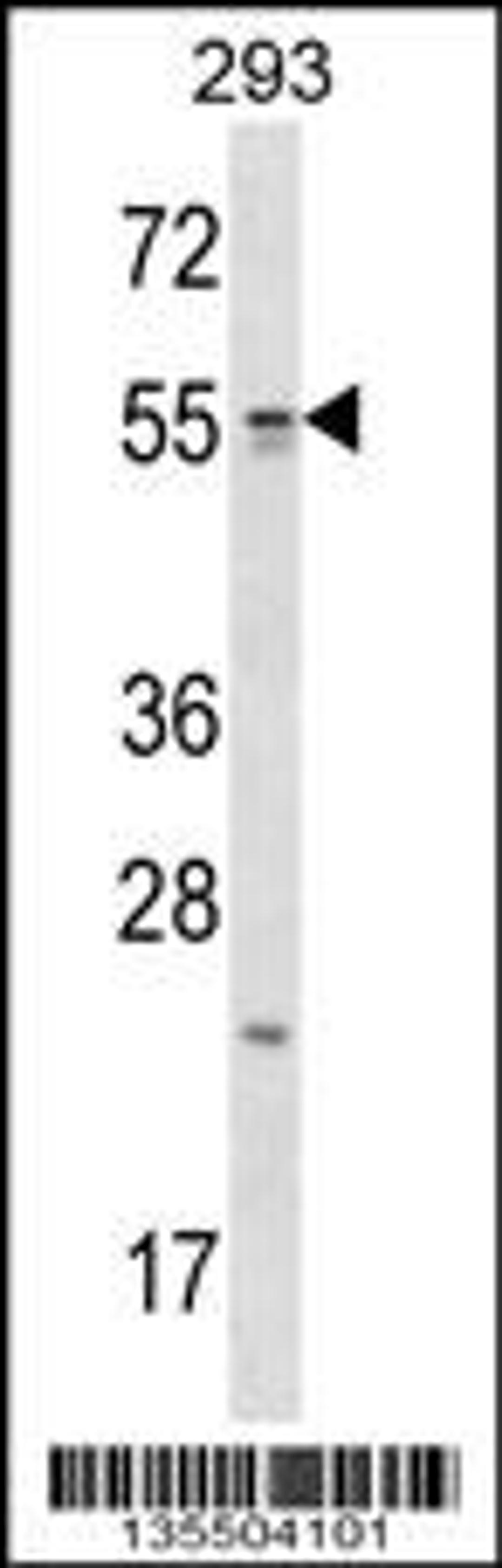 Western blot analysis in 293 cell line lysates (35ug/lane).