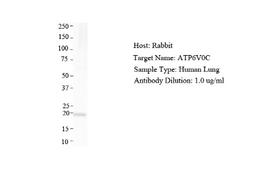 Western Blot: ATP6V0C Antibody [NBP1-59654] - Human Lung, Antibody Dilution: 1.0 ug/ml.