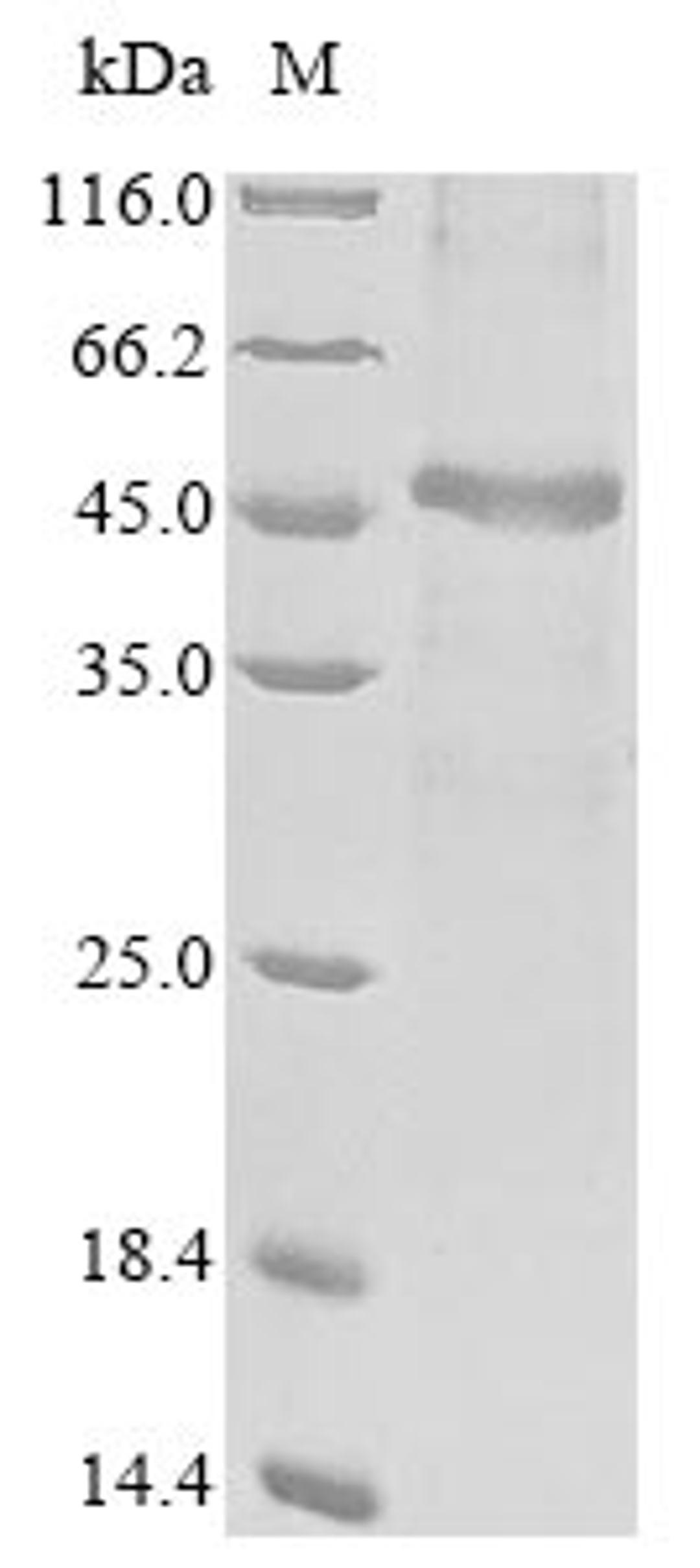 (Tris-Glycine gel) Discontinuous SDS-PAGE (reduced) with 5% enrichment gel and 15% separation gel.