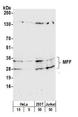 Detection of human and mouse MFF by WB.