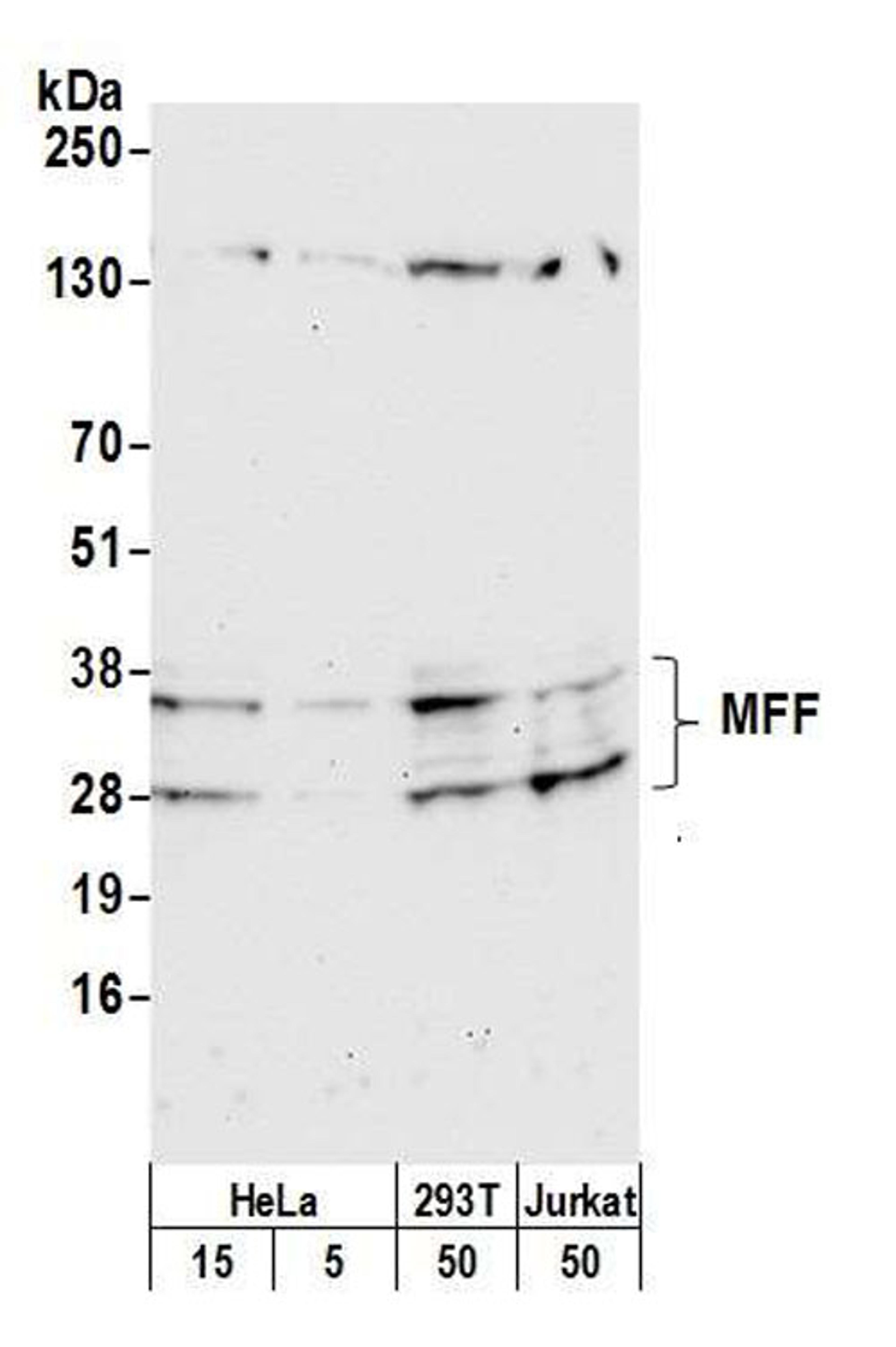 Detection of human and mouse MFF by WB.