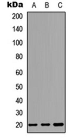 Western blot analysis of HEK293T (Lane 1), Raw264.7 (Lane 2), PC12 (Lane 3) whole cell lysates using CD269 antibody