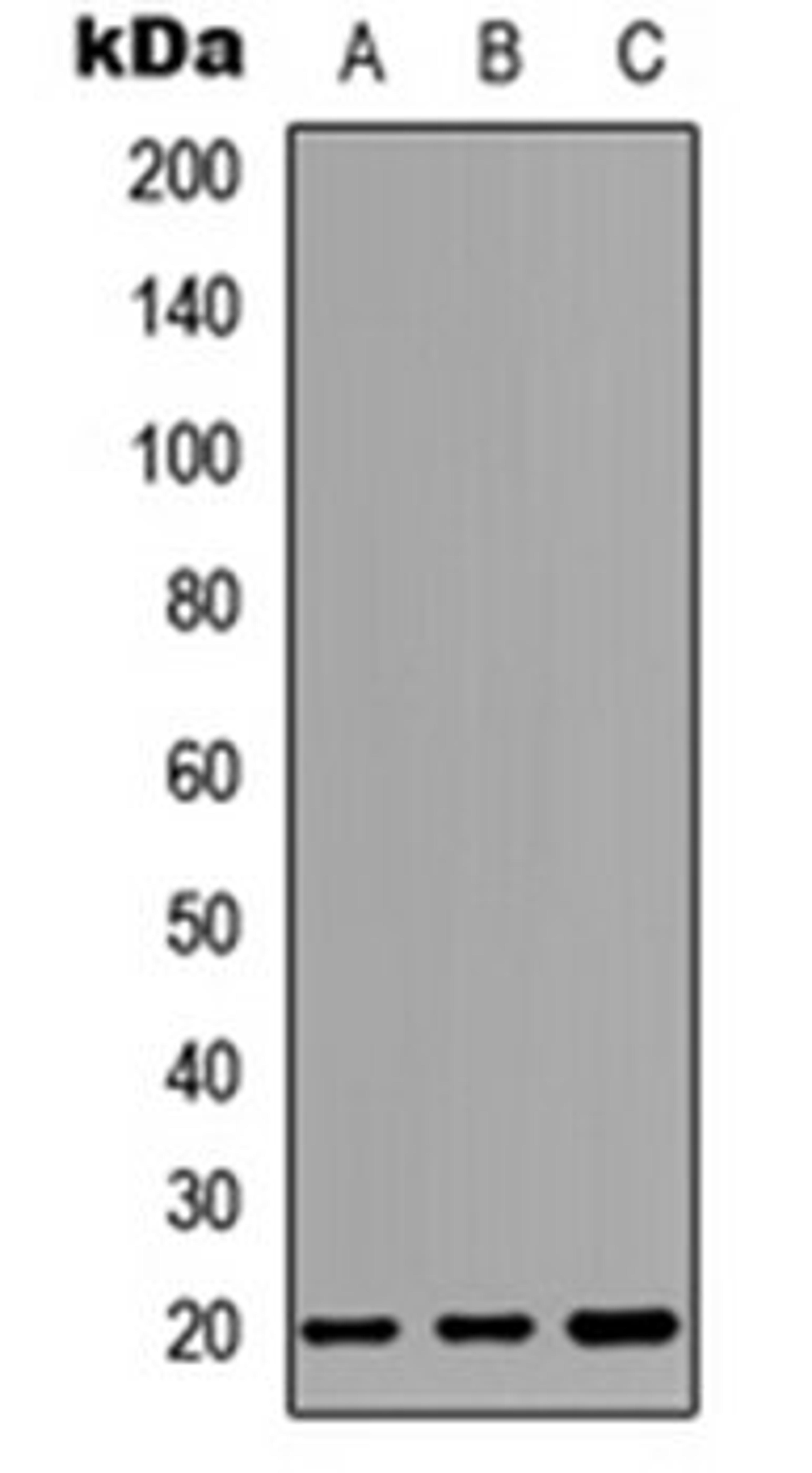 Western blot analysis of HEK293T (Lane 1), Raw264.7 (Lane 2), PC12 (Lane 3) whole cell lysates using CD269 antibody