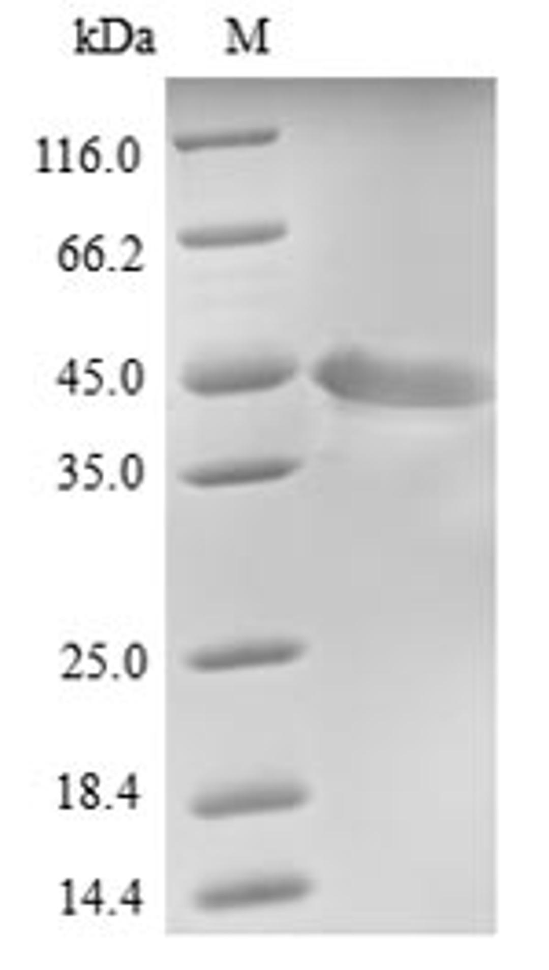 (Tris-Glycine gel) Discontinuous SDS-PAGE (reduced) with 5% enrichment gel and 15% separation gel.