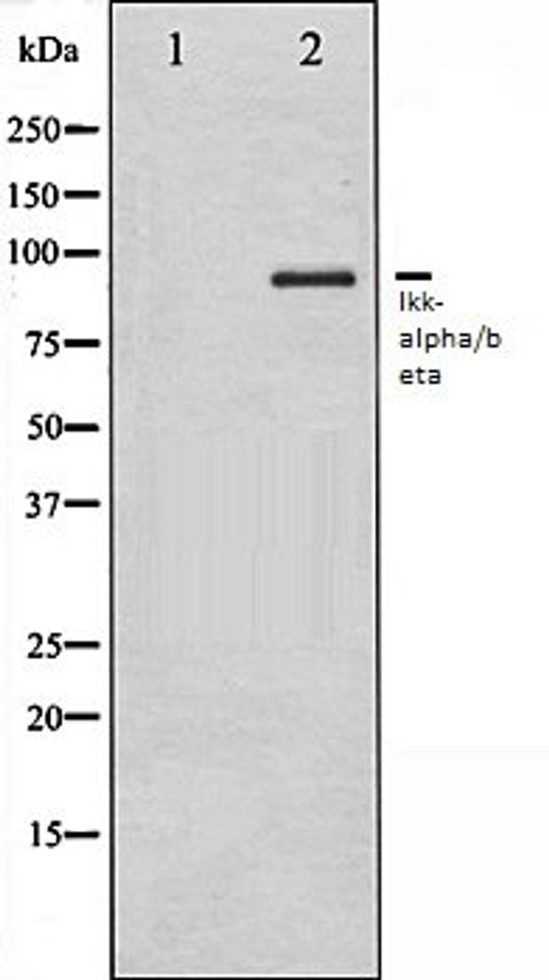 Western blot analysis of HepG2 whole cell lysates using IKK-alpha/beta antibody, The lane on the left is treated with the antigen-specific peptide.