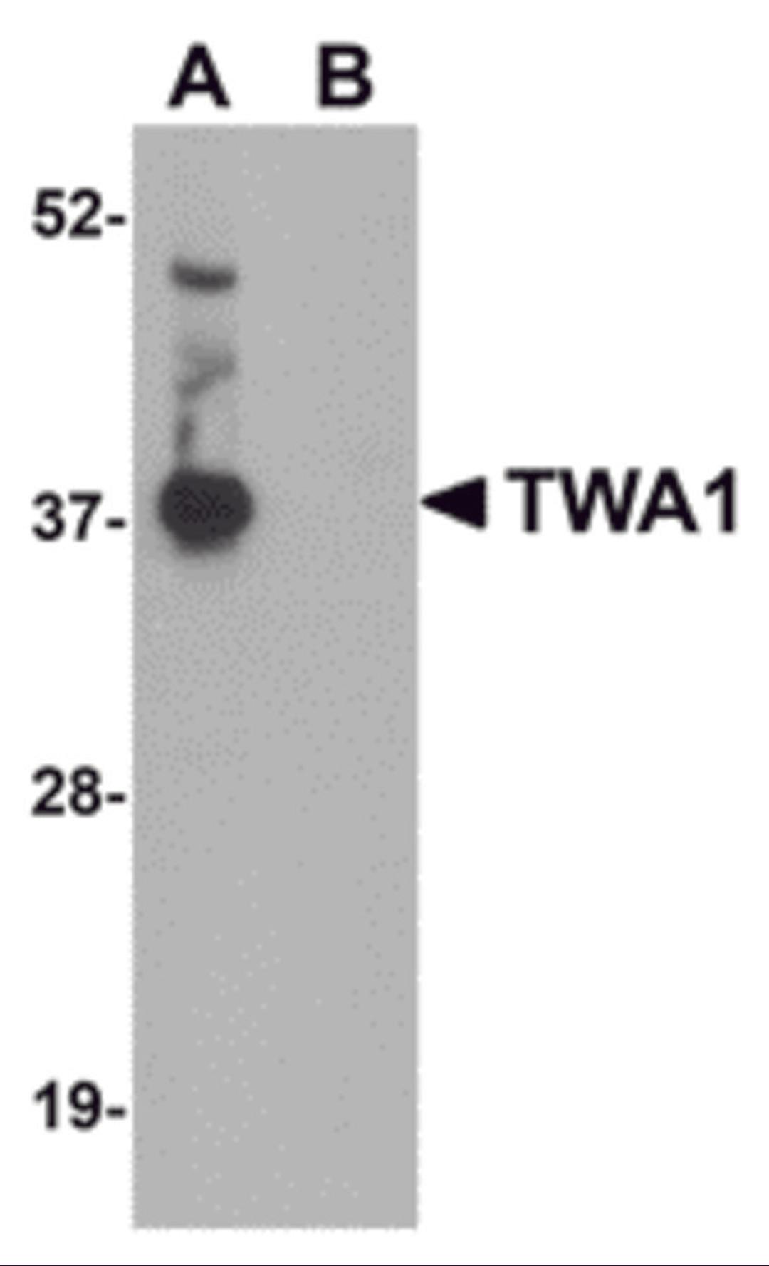 Western blot analysis of TWA1 in human brain tissue lysate with TWA1 antibody at 1 &#956;g/mL in (A) the absence and (B) the presence of blocking peptide.