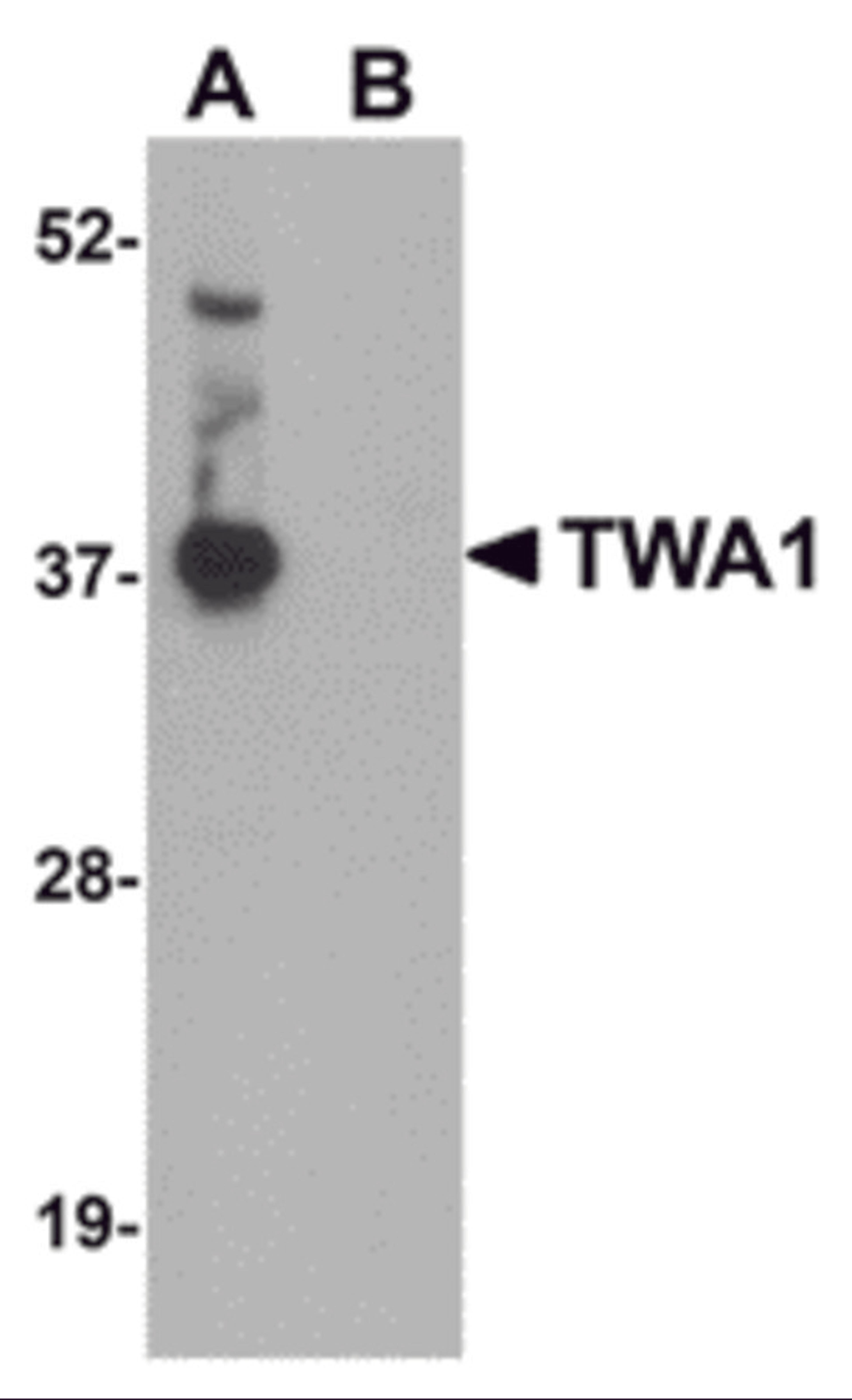 Western blot analysis of TWA1 in human brain tissue lysate with TWA1 antibody at 1 &#956;g/mL in (A) the absence and (B) the presence of blocking peptide.