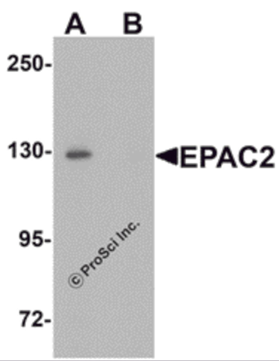 Western blot analysis of EPAC2 in rat liver tissue lysate with EPAC2 antibody at 1 μg/mL in (A) the absence and (B) the presence of blocking peptide.
