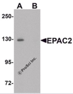 Western blot analysis of EPAC2 in rat liver tissue lysate with EPAC2 antibody at 1 μg/mL in (A) the absence and (B) the presence of blocking peptide.