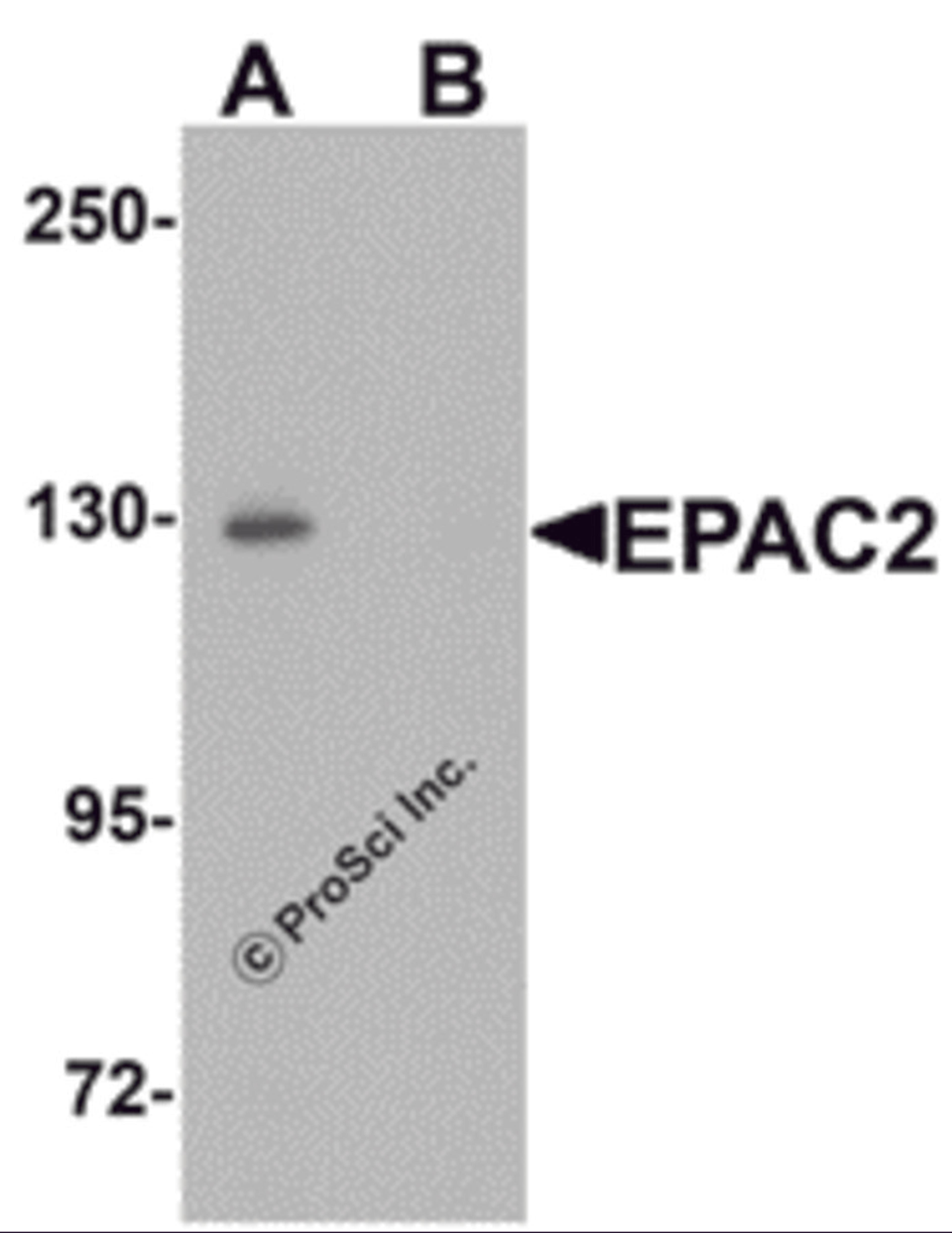 Western blot analysis of EPAC2 in rat liver tissue lysate with EPAC2 antibody at 1 μg/mL in (A) the absence and (B) the presence of blocking peptide.