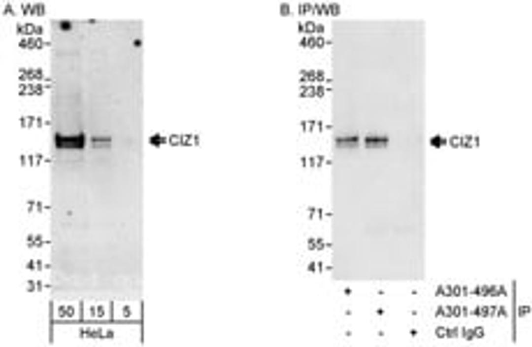 Detection of human CIZ1 by western blot and immunoprecipitation.